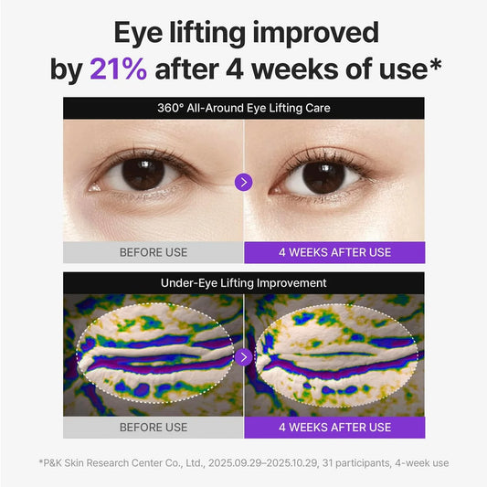 360º Shot PDRN lifting Eye cream || 30ml || Buy 1 get 1 free