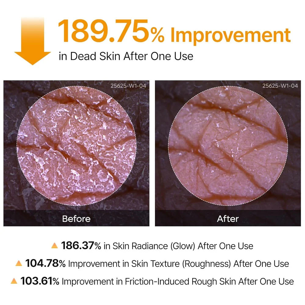 Dr.Melaxin Peel Shot Exfoliating Kojic Acid Turmeric Spray 200ml