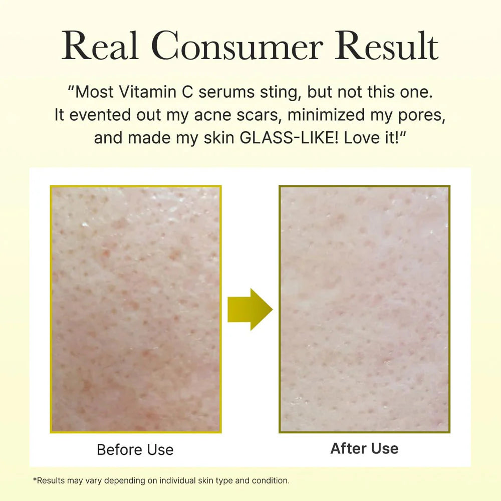 Arencia Vitamin C Booster Shot 30ml (Cash On Delivery + Free DC)