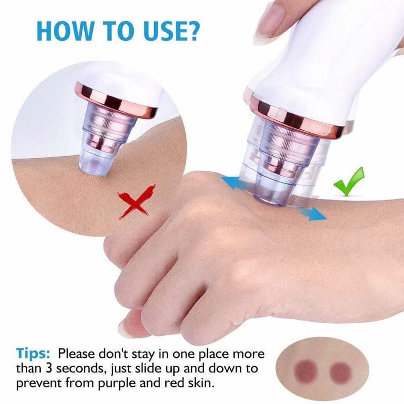 Rechargeable Vacuum Pore Cleaner, 5 In 1 Blackheads Removing Device Electric Derma suction Machine | USB Rechargeable Acne Pimple Pore Cleaner Vacuum tool - Facial Cleanser Device for Nose & Skin Care